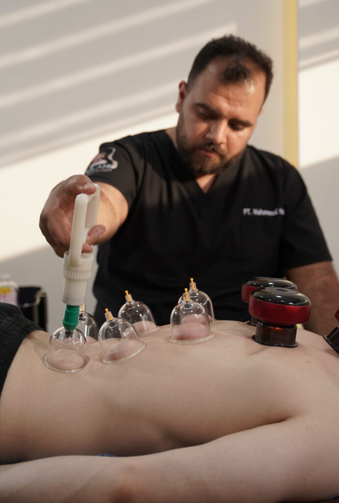 Close-up of cupping therapy applied on a patient's back during physiotherapy